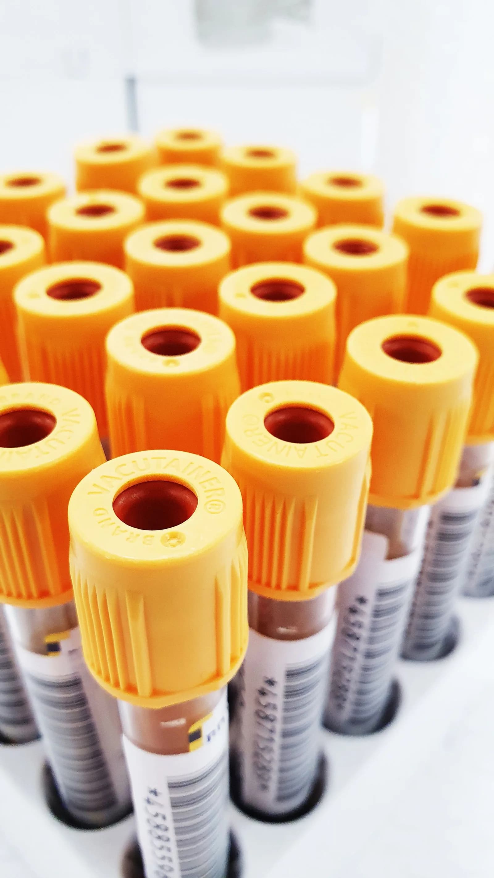 Tubos de ensaio com amostras de sangue em laboratório