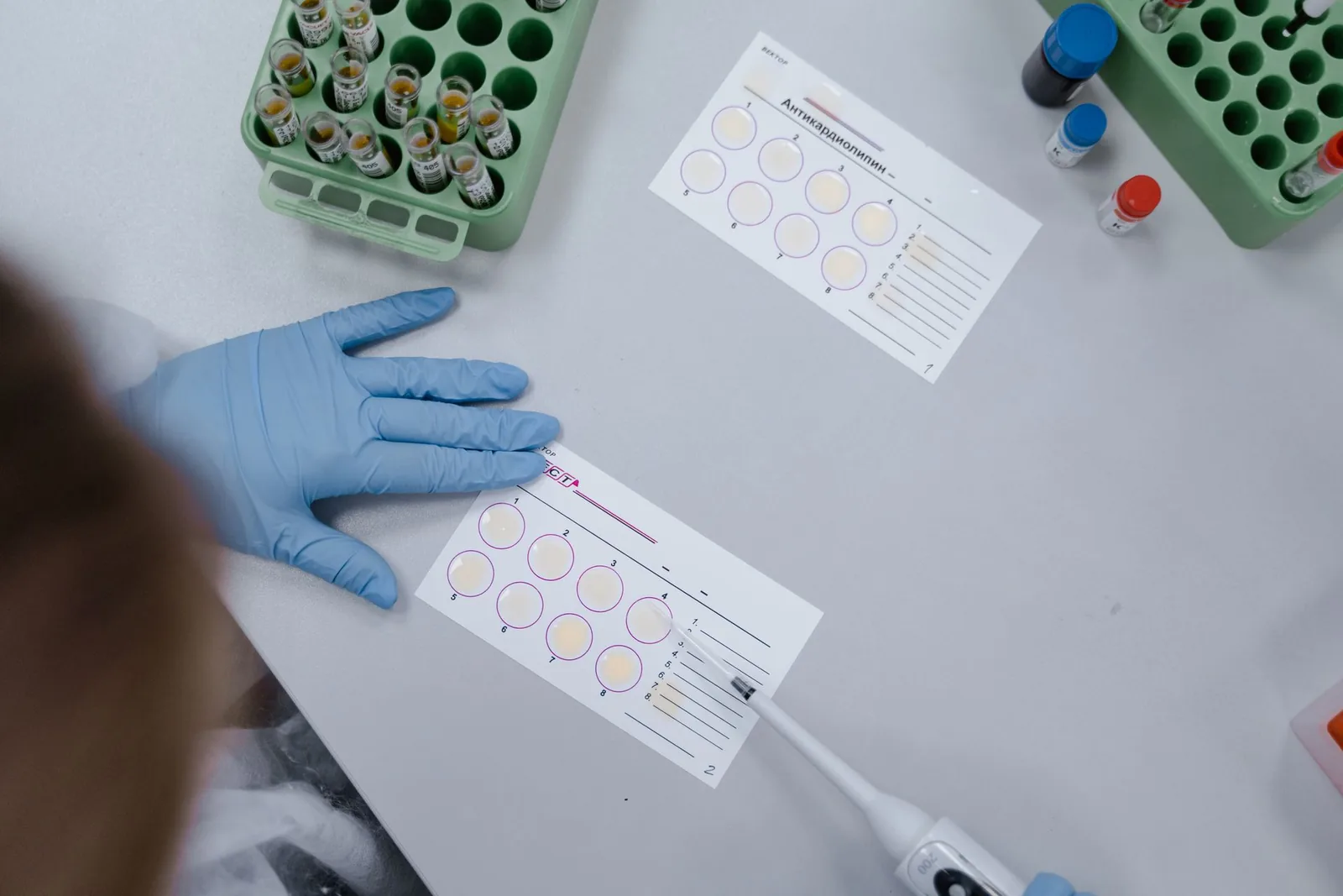 Cientista analisando amostras em ambiente de laboratório